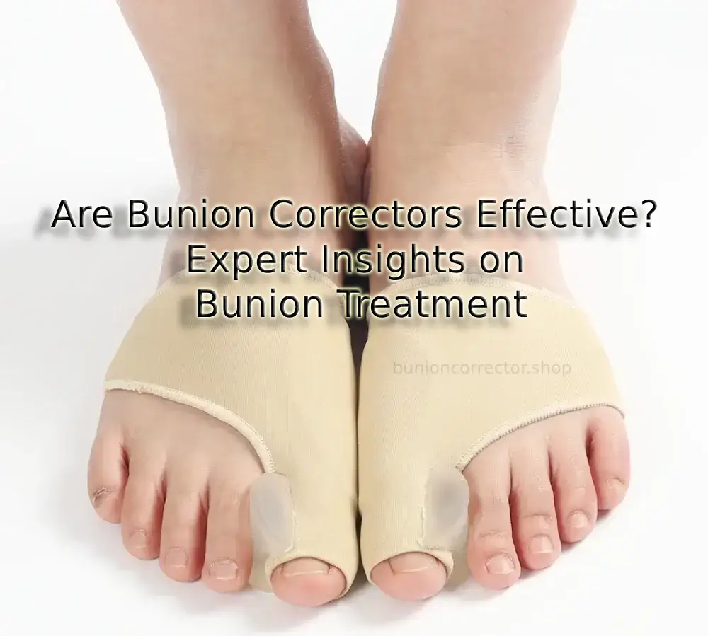 Are Bunion Correctors Effective