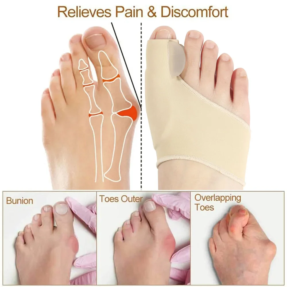 benefits of bunion corrector