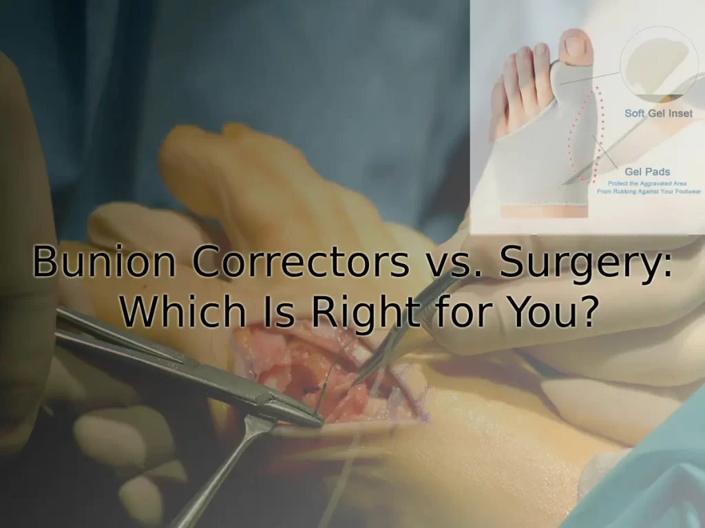 Bunion Correctors vs. Surgery: Which Is Right for You?