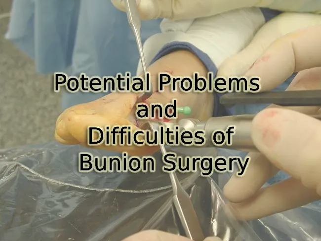 problems and difficulties of bunion surgery