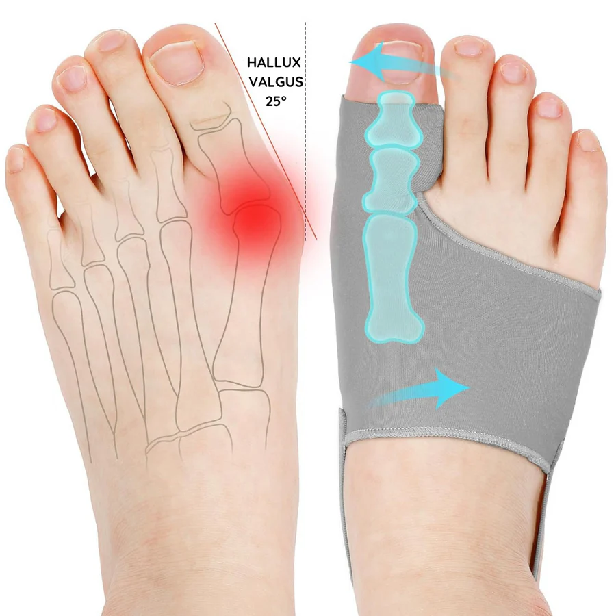 bunion corrector