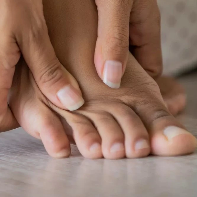 bunion symptoms