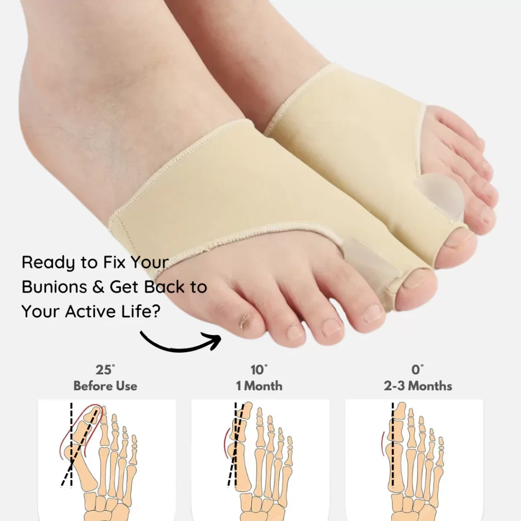 how to use a bunion corrector