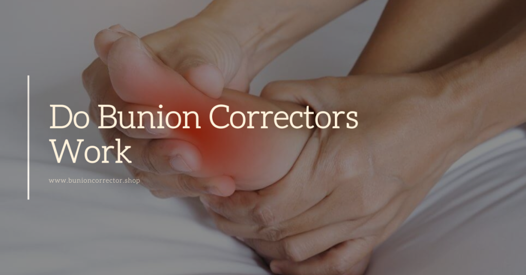 do bunion correctors work