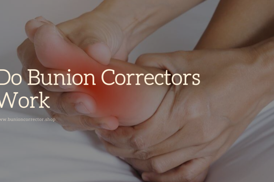 do bunion correctors work