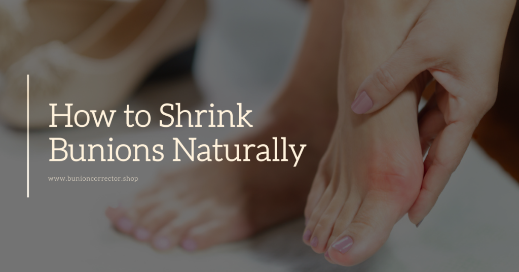 how to shrink bunions naturally