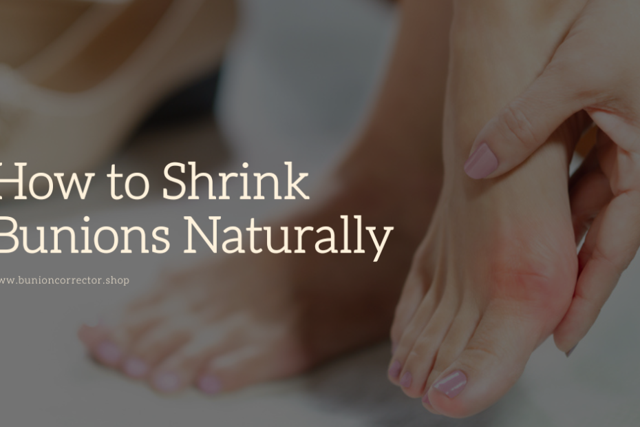 how to shrink bunions naturally